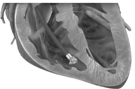 koulouridiscardiologist koulouridis cardiologist Κουλουρίδης καρδιολόγος