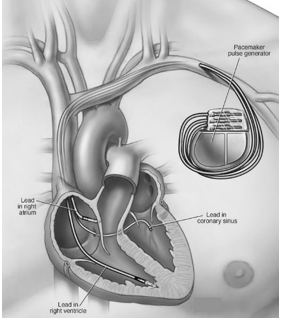 koulouridiscardiologist koulouridis cardiologist Κουλουρίδης καρδιολόγος